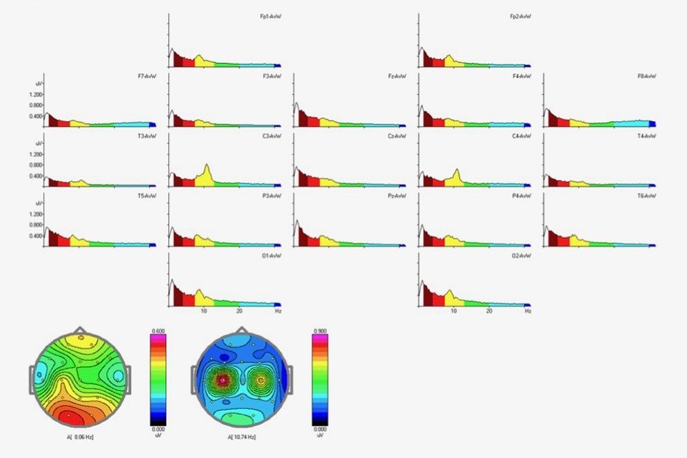 brain wave analysis