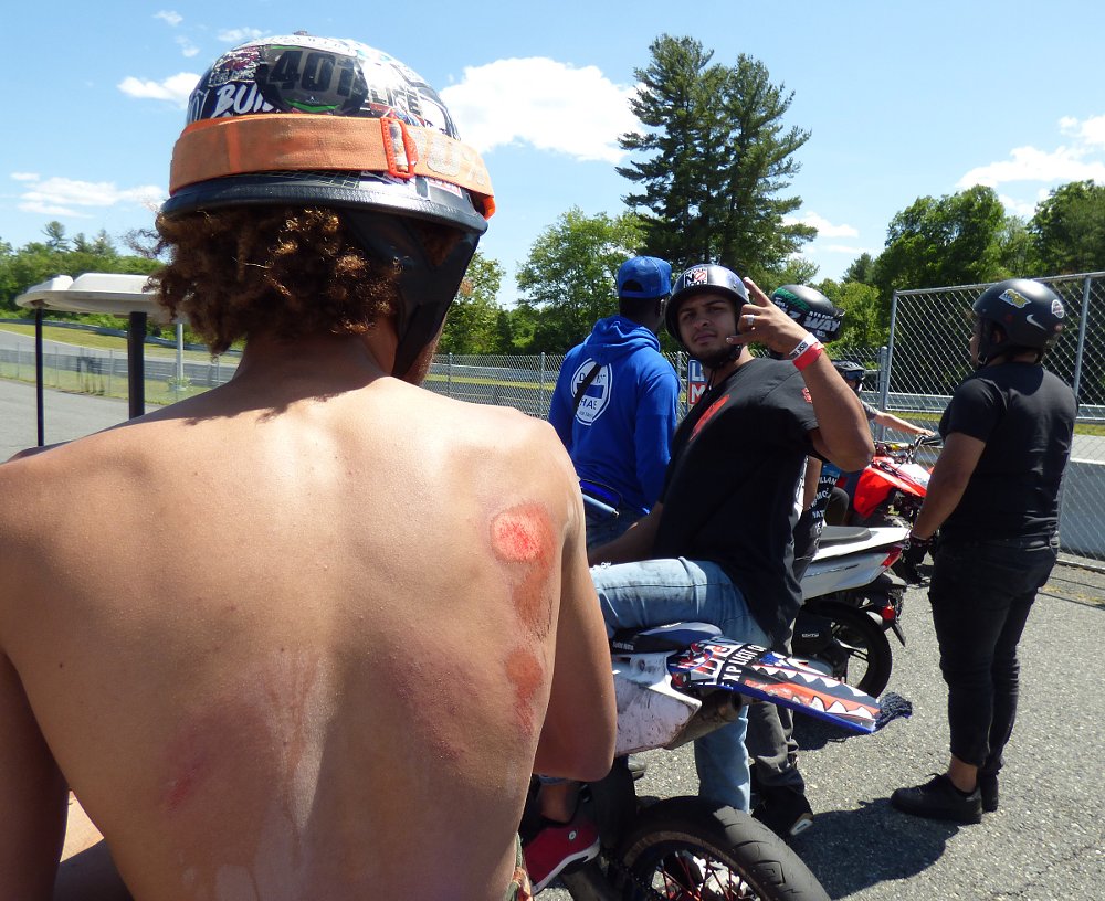 rider with scrape on his shoulder